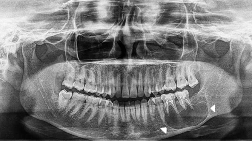 Radiografía panorámica dental entregada por Oralink